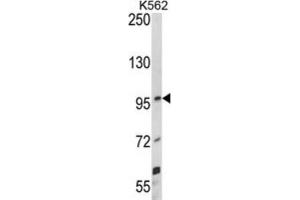 Western Blotting (WB) image for anti-Unc-5 Homolog C (C. Elegans) (Unc5c) antibody (ABIN3002880)