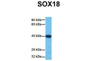 Western Blotting (WB) image for anti-SRY (Sex Determining Region Y)-Box 18 (SOX18) (Middle Region) antibody (ABIN2777725)