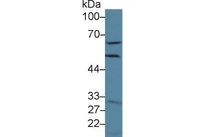 Detection of GCLM in Human Hela cell lysate using Polyclonal Antibody to Glutamate Cysteine Ligase, Modifier Subunit (GCLM) (GCLM 抗体  (AA 40-251))