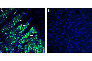 Expression of SLC18B1 in mouse striatum.