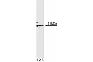 Western blot analysis of HNF-1beta on a rat kidney lysate. (HNF1B 抗体  (AA 1-101))