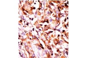 Image no. 1 for anti-BCL2-Associated Agonist of Cell Death (BAD) (pSer99) antibody (ABIN358087) (BAD 抗体  (pSer99))