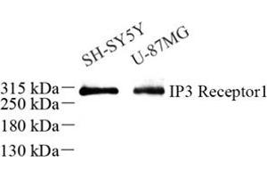 Western blot analysis of IP3R1 (ABIN7074293) at dilution of 1: 500 (IP3 Receptor 抗体)