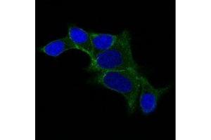 Image no. 1 for anti-Ornithine Decarboxylase 1 (ODC1) antibody (ABIN6188965) (ODC1 抗体)