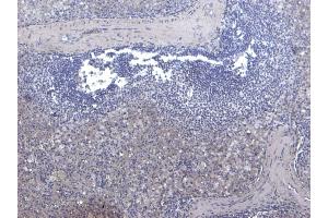 (ABIN185707) Negative Control showing staining of paraffin embedded Human Spleen, with no primary antibody. (Septin 1 抗体  (Internal Region))