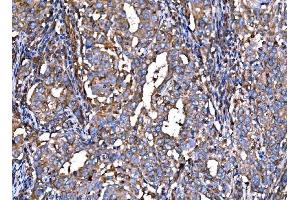 IHC analysis of RPL32 using anti-RPL32 antibody (ABIN7601826). (RPL32 抗体  (AA 48-129))