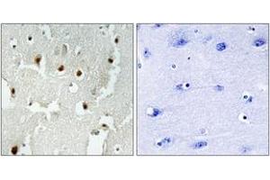 Immunohistochemistry analysis of paraffin-embedded human brain tissue, using TREF1 Antibody.