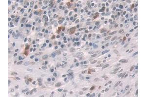 Immunohistochemistry (IHC) image for anti-Nuclear Receptor Subfamily 3, Group C, Member 1 (Glucocorticoid Receptor) (NR3C1) (AA 532-730) antibody (ABIN1860047)