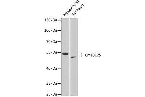 Western blot analysis of extracts of various cell lines, using Gm13125 antibody. (Pramel15 抗体)
