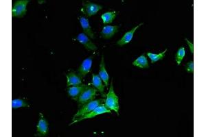 Immunofluorescent analysis of Hela cells using ABIN7175541 at dilution of 1:100 and Alexa Fluor 488-congugated AffiniPure Goat Anti-Rabbit IgG(H+L) (PROC 抗体  (AA 288-409))