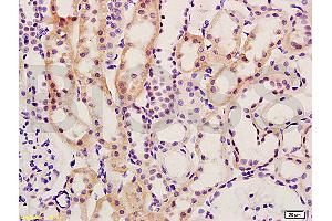 Formalin-fixed and paraffin embedded rat kidney tissue labeled with Anti-Smad7/Smad6 Polyclonal Antibody (ABIN670206), Unconjugated at 1:200, followed by conjugation to the secondary antibody and DAB staining (SMAD7 抗体  (AA 1-100))