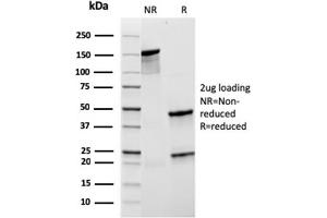 SDS-PAGE Analysis Purified CD21 Recombinant Mouse Monoclonal Antibody (rCR2/1952). (Recombinant CD21 抗体  (AA 44-196))