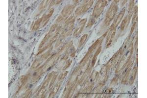 Image no. 1 for anti-Pyruvate Dehydrogenase beta (PDHB) (AA 250-360) antibody (ABIN598861) (PDHB 抗体  (AA 250-360))