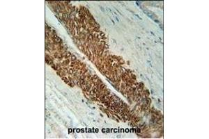 Immunohistochemistry (Paraffin-embedded Sections) (IHC (p)) image for anti-STEAP Family Member 2, Metalloreductase (STEAP2) (AA 229-258) antibody (ABIN651772)