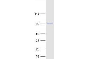 Western Blotting (WB) image for Fucosyltransferase 11 (Alpha (1,3) Fucosyltransferase) (FUT11) protein (Myc-DYKDDDDK Tag) (ABIN2721447)