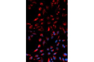 Immunofluorescence (IF) image for anti-Carboxypeptidase E (CPE) antibody (ABIN1876646) (CPE 抗体)