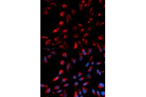 Immunofluorescence (IF) image for anti-Carboxypeptidase E (CPE) antibody (ABIN1876646)