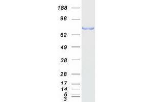 Western Blotting (WB) image for SMAD Specific E3 Ubiquitin Protein Ligase 2 (SMURF2) protein (Myc-DYKDDDDK Tag) (ABIN2732271)
