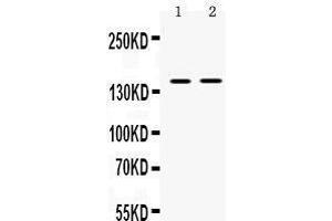 Observed bind size: 150KD (TRIM33 抗体  (AA 1001-1127))