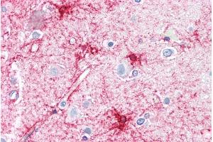 Immunohistochemistry (IHC) image for anti-Vacuolar Protein Sorting 45 (VPS45) (C-Term) antibody (ABIN185111)
