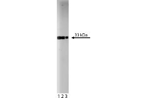 Western Blotting (WB) image for anti-Cyclin-Dependent Kinase 2 (CDK2) (AA 109-298) antibody (ABIN967777) (CDK2 抗体  (AA 109-298))