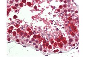Human, Testis: Formalin-Fixed Paraffin-Embedded (FFPE) (C22orf28 抗体  (AA 201-214))