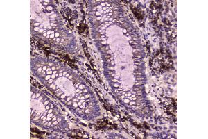 IHC analysis of IGF2R using anti-IGF2R antibody . (IGF2R 抗体  (AA 424-529))