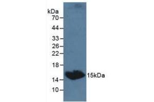 Detection of TSHb in Canine Serum using Polyclonal Antibody to Thyroid Stimulating Hormone Beta (TSHb) (TSHB 抗体  (AA 20-138))