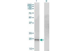 Western Blot analysis of CDO1 expression in transfected 293T cell line by CDO1 monoclonal antibody (M09), clone 4B4. (CDO1 抗体  (AA 101-200))
