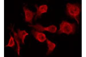 ABIN6266926 staining A549 by IF/ICC. (CERKL 抗体  (Internal Region))