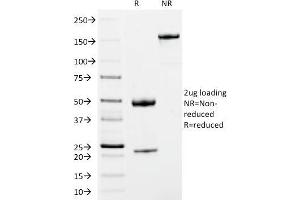 anti-Immunoglobulin Heavy Constant mu (IGHM) antibody (CF®488A)