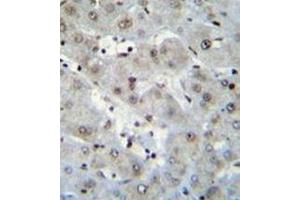 Immunohistochemistry analysis in formalin fixed and paraffin embedded human liver tissue reacted with H2AFZ Antibody (C-term) followed by peroxidase conjugation of the secondary antibody and DAB staining. (H2AFZ 抗体  (C-Term))