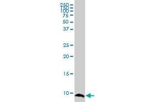ATOX1 monoclonal antibody (M04), clone 3G11. (ATOX1 抗体  (AA 1-68))