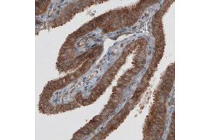 Immunohistochemical staining (Formalin-fixed paraffin-embedded sections) of human fallopian tube with VPS26A monoclonal antibody, clone CL2287  shows strong granular cytoplasmic immunoreactivity in glandular epithelium cells.
