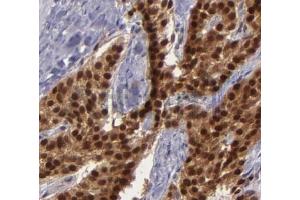 ABIN6268682 at 1/100 staining human breast tissues sections by IHC-P. (BAG1 抗体  (N-Term))