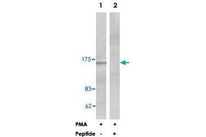 Western blot analysis of extracts from HeLa cells treated with PMA (125 ng/ml, 30 min), using PLCB3 polyclonal antibody . (PLCB3 抗体  (Ser1105))