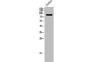 Western Blot analysis of Jurkat cells using Relaxin Receptor 2 Polyclonal Antibody (RXFP2 抗体  (Internal Region))