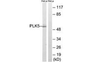 Western blot analysis of extracts from HeLa cells, using PLK5 Antibody. (PLK5 抗体  (AA 131-180))