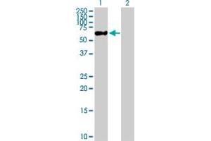 Western Blot analysis of ZNF671 expression in transfected 293T cell line by ZNF671 MaxPab polyclonal antibody. (ZNF671 抗体  (AA 1-556))
