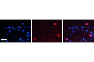 MAP2K2 antibody - C-terminal region          Formalin Fixed Paraffin Embedded Tissue:  Human Lung Tissue    Observed Staining:  Cytoplasm of pneumocytes   Primary Antibody Concentration:  1:600    Secondary Antibody:  Donkey anti-Rabbit-Cy3    Secondary Antibody Concentration:  1:200    Magnification:  20X    Exposure Time:  0. (MEK2 抗体  (C-Term))