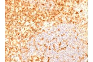 Formalin-fixed, paraffin-embedded human Tonsil stained with CD27 Recombinant Mouse Monoclonal Antibody (rLPFS2/1611). (Recombinant CD27 抗体)
