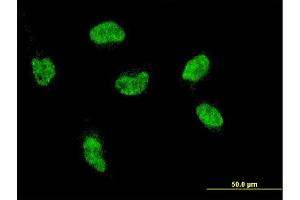 Immunofluorescence of monoclonal antibody to HOXA5 on HeLa cell. (HOXA5 抗体  (AA 171-270))