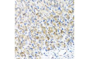 Immunohistochemistry of paraffin-embedded mouse stomach using RAD51C antibody (ABIN5974185) at dilution of 1/100 (40x lens). (RAD51C 抗体)