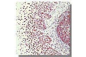 Image no. 1 for anti-X-Ray Repair Complementing Defective Repair in Chinese Hamster Cells 6 (XRCC6) antibody (ABIN187448) (XRCC6 抗体)