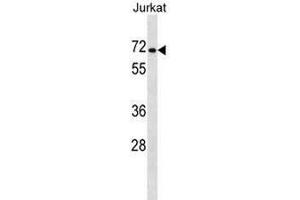 PRODH2 Antibody (Center) western blot analysis in Jurkat cell line lysates (35µg/lane). (PRODH2 抗体  (Middle Region))