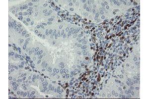 Image no. 1 for anti-GTPase, IMAP Family Member 4 (GIMAP4) antibody (ABIN1498460) (GIMAP4 抗体)