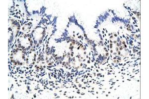 Zinc Finger Protein 296 (ZNF296) (C-Term) Antikörper