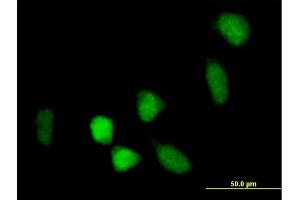 Immunofluorescence of purified MaxPab antibody to BCOR on HeLa cell.