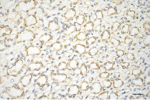 Immunohistochemistry was performed on paraffin-embedded mouse kidney using AGL antibody (ABIN7797592), 1:200). (Recombinant AGL 抗体)