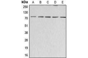 Western blot analysis of ABCG2 expression in HeLa (A), SP2/0 (B), H9C2 (C), HEK293T (D), HepG2 (E) whole cell lysates. (ABCG2 抗体  (Center))